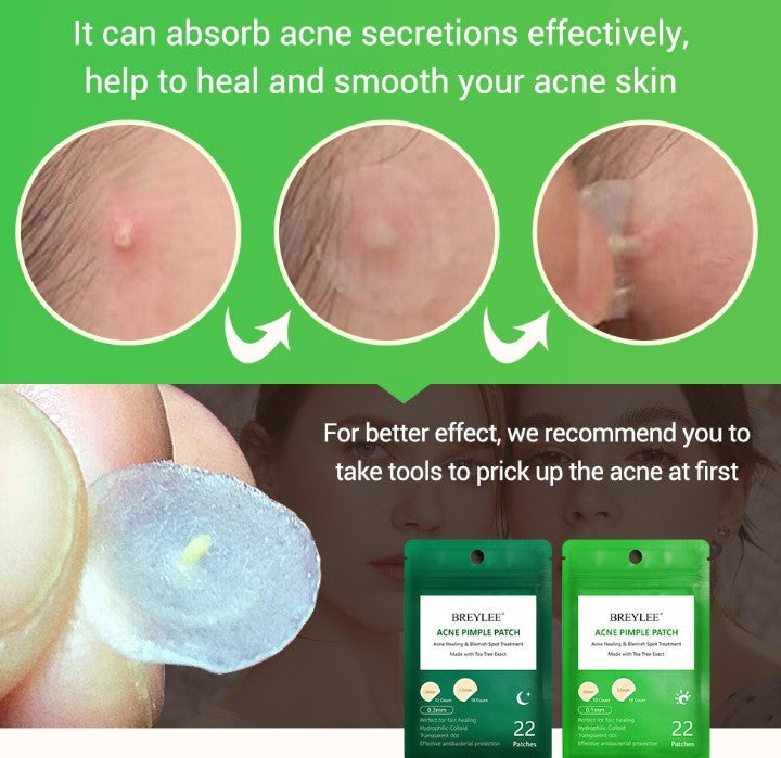 Tea Tree Acne Patch Fades Acne Marks and Ultra-thin Viralgem Store