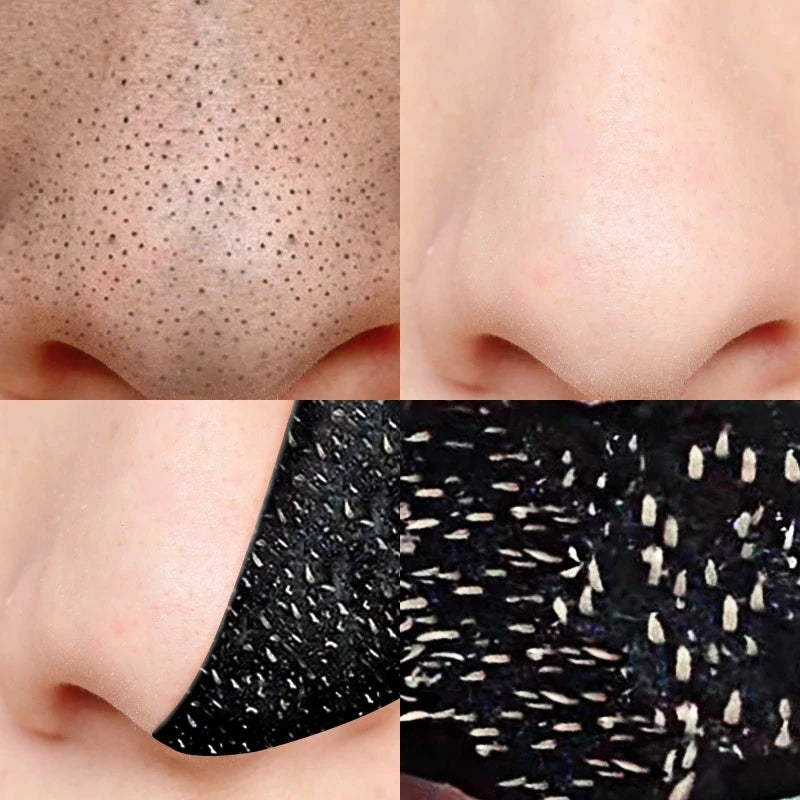 Unisex Deep Cleansing Nose Strips for Acne & Blackhead Removal Shrink Pore Nose Black Head Stickers Skin Care Patch