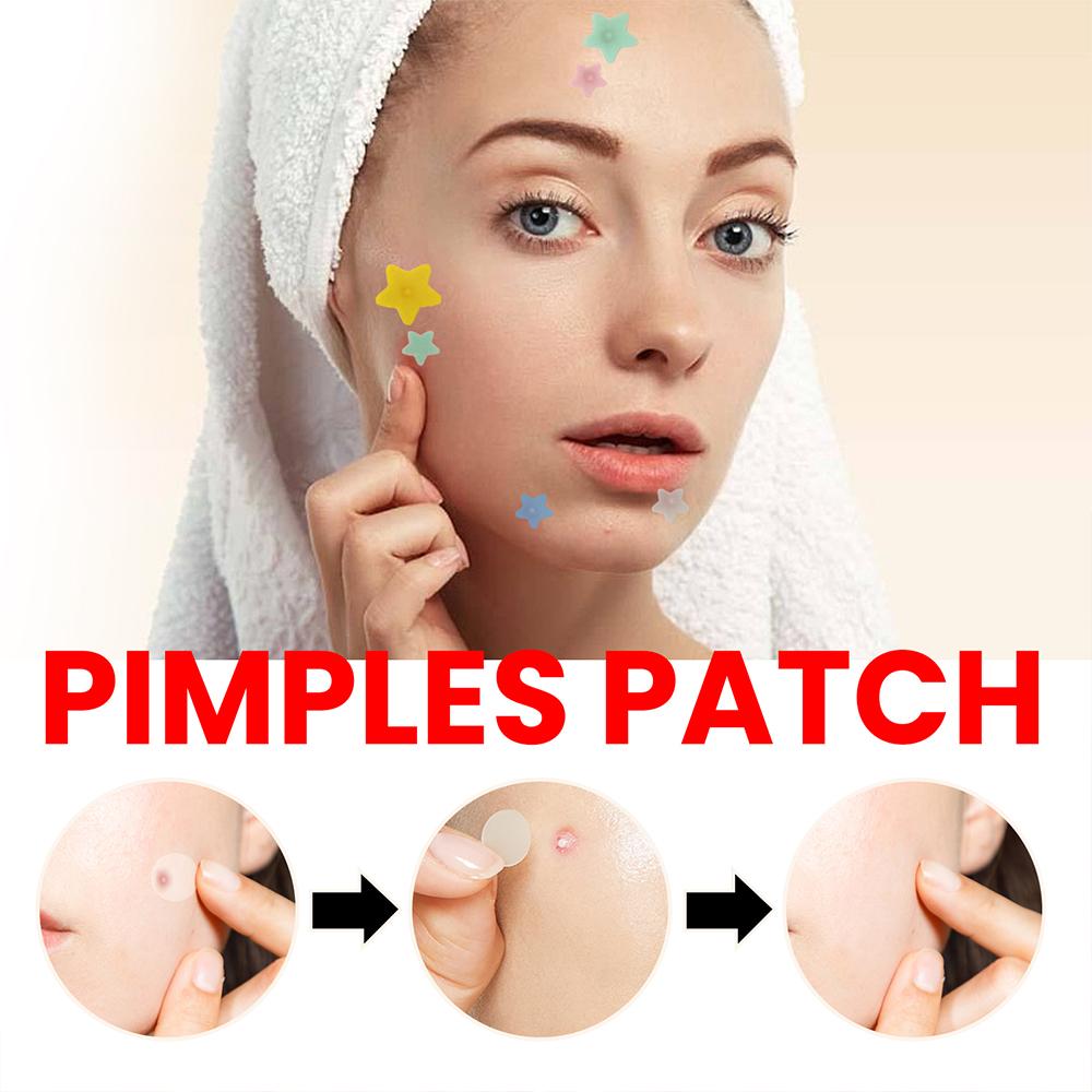 200pcs/set Invisible Acne Pimple Patch Professional Face Skin Care Repair Acne Healing Absorbing Spot Sticker For Men Women
