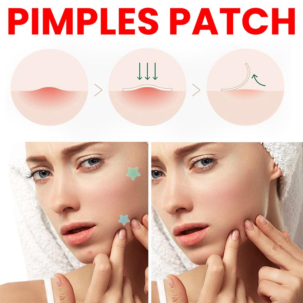 200pcs/set Invisible Acne Pimple Patch Professional Face Skin Care Repair Acne Healing Absorbing Spot Sticker For Men Women