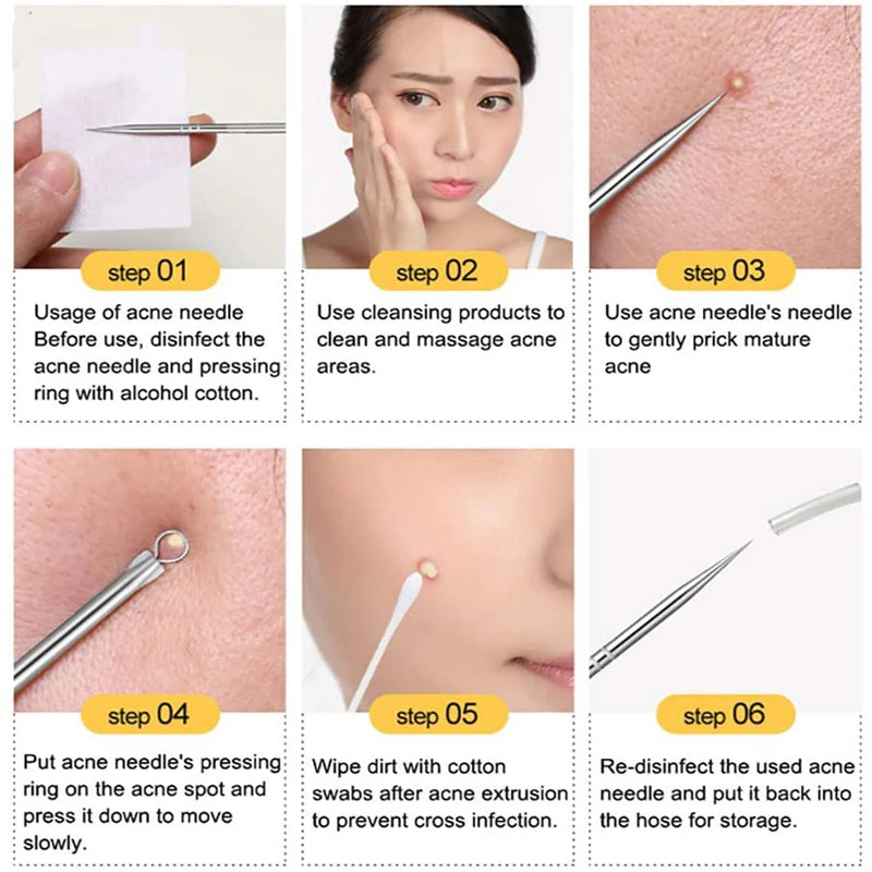 4Pcs Blackhead Black Spot Acne Comedone Pimple Blemish Remover Skin Care Women Beauty Acne Treatment Pore Cleanser Needle Hook Viralgem Store