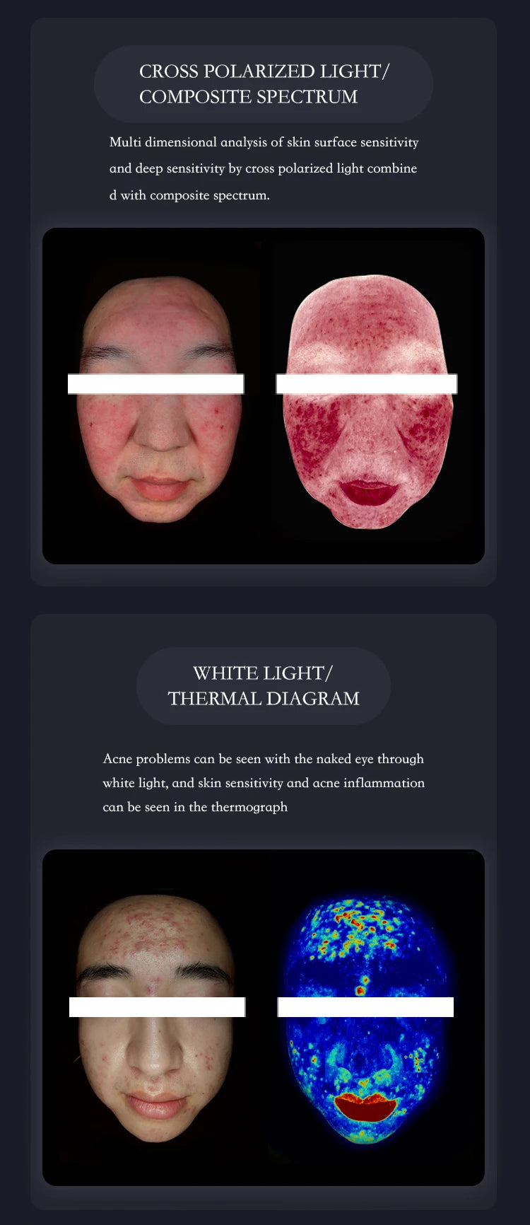 AISIA Q1 3D AI Facial Skin Analyzer Detection Skin Problem Diagnosis 8 Spectrum Professional Analysis Beauty Salon Equipment Viralgem Store