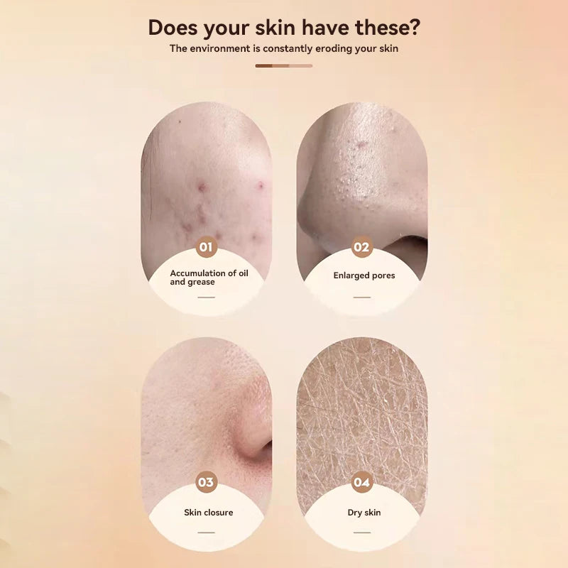 Vaseline Moisturizing Cream Lefthansa Sheep Oil Moisturizing Lotion Prevent Dry Cracked Skin Winter Face Cream Hand Care Cream