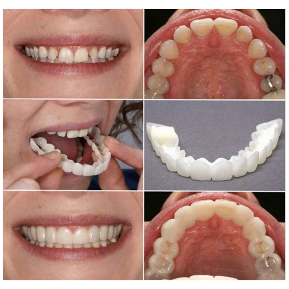 1-5Set Upper Lower Temporary Fit Fake Teeth Cosmetic Denture Smile Veneers False Teeth Brace Cover Upper False Tooth Cover Snap Viralgem Store