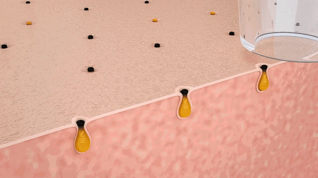 Visual Blackhead Remover Facial Deep Clean Machine Blackheads and Acne Remover Heated Face Extractor Electric Blackhead Sucker