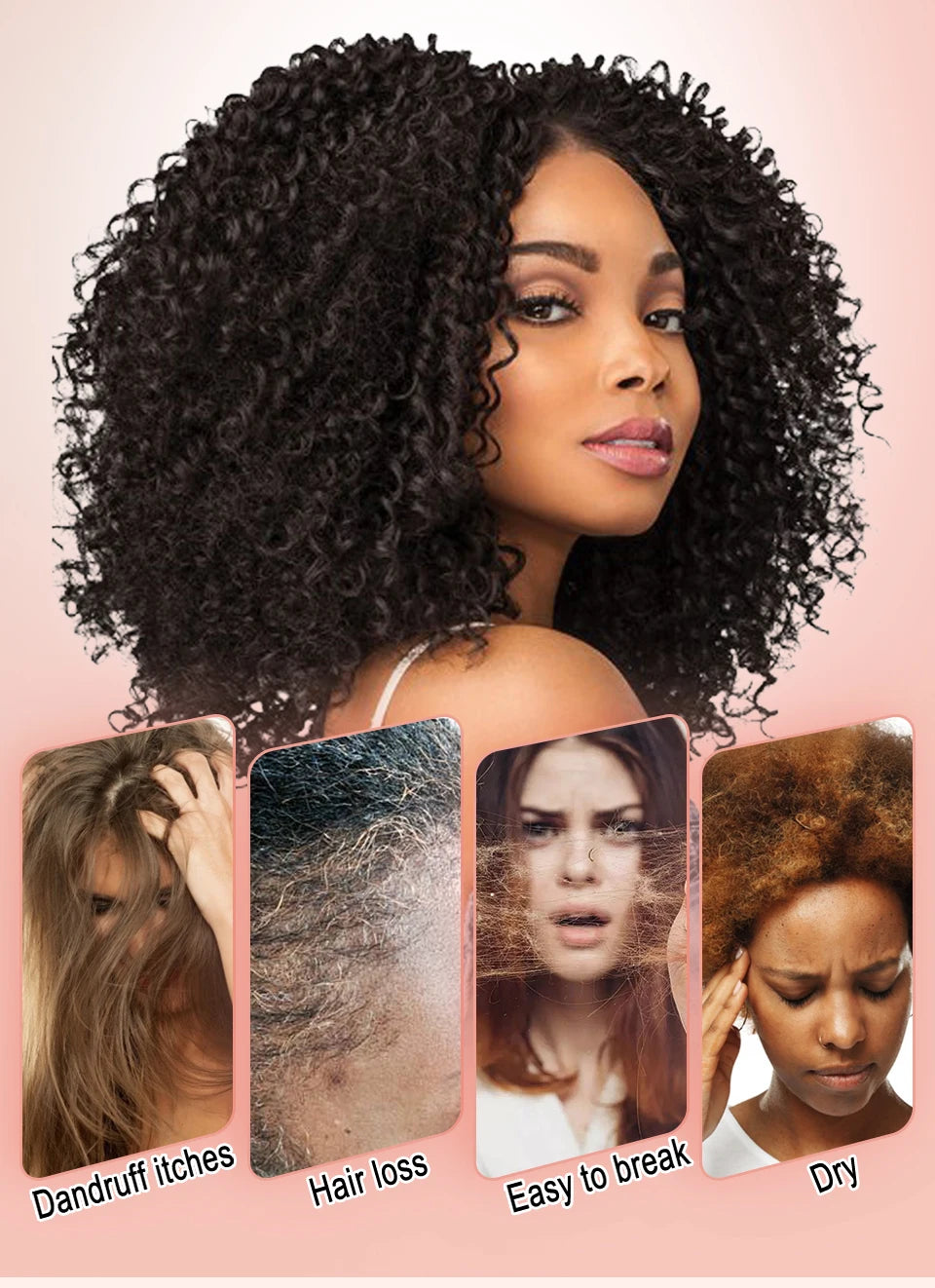 Super 5x Fenugreek Anti-Hair Loss Oil For Man Hair Treatment Fast Regrowth Thicken Oils Scalp Damaged  Repair Care Products Viralgem Store