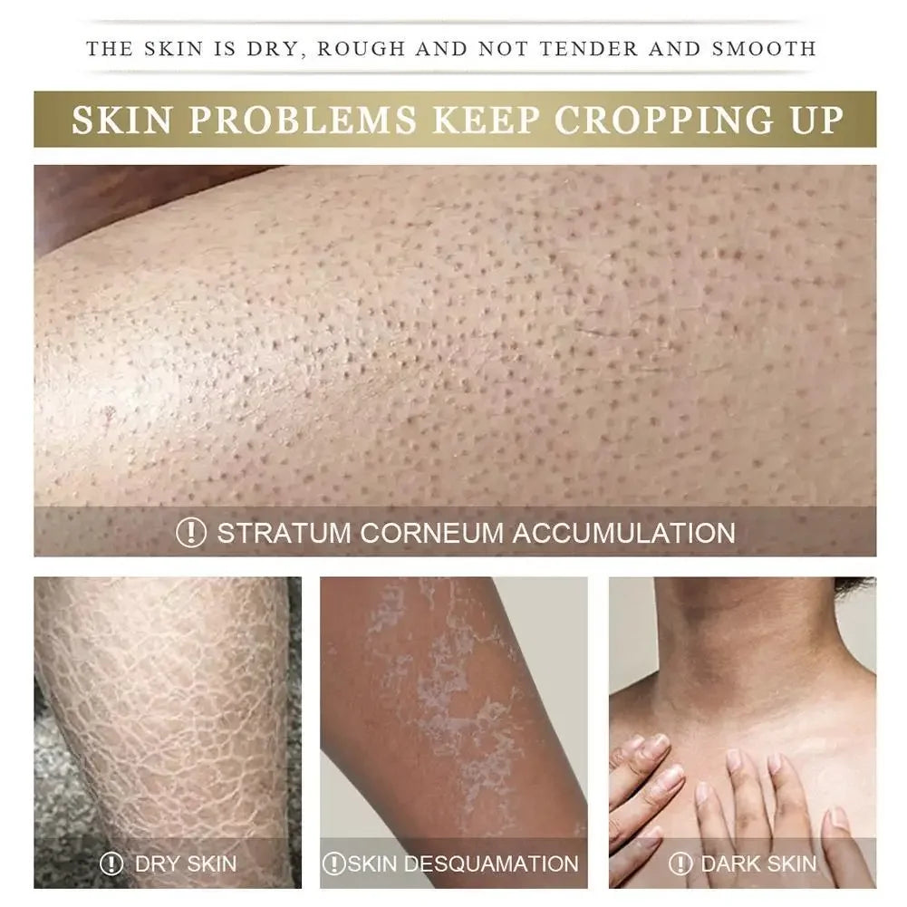 7-Day Fast Body Scrub Cream Moisturizing Skin Repair Keratosis Pilaris Removing Strawberry Legs Eraser Nourishing Body Skin Care Viralgem Store