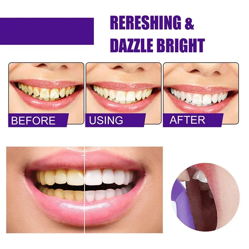 50ml V34 Mousse Toothpaste Teeth Whitening Removing Yellow Teeth Cleaning Tooth Stain Oral Fresh Tooth Care Product 2024 New