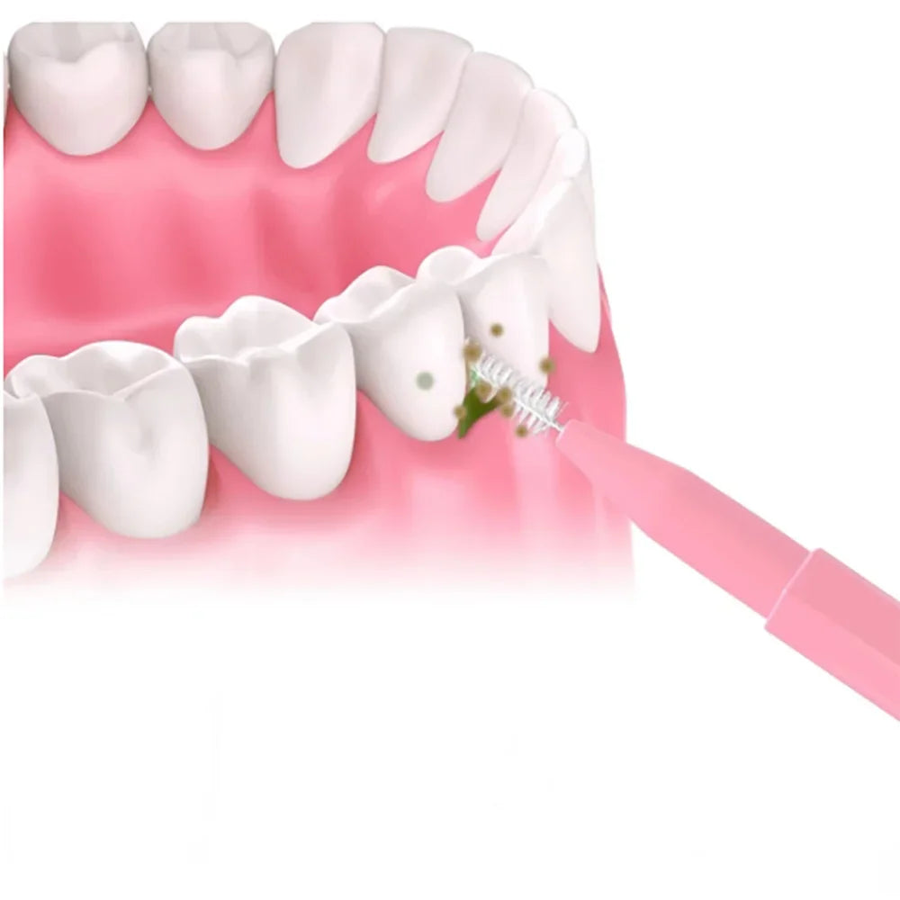 30pcsInterdental Brushes Dental Brush Between Teeth For Dental Orthodontic Clean Between Teeth Cleaning Tools Soft Micro Brushes