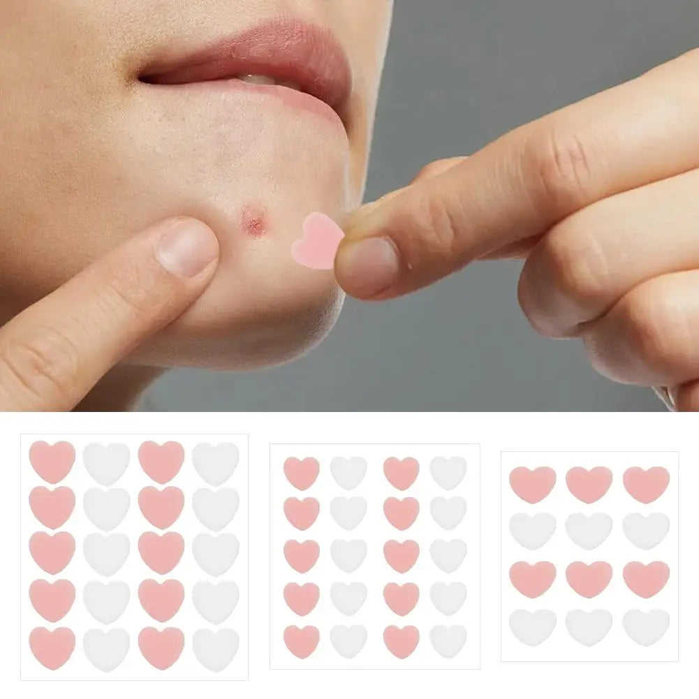 12/20 Counts Acne Care Patches Cute Pink Heart Shaped Acne Pimple Patches Invisible Acne Cover Treatment Stickers Skin Care Viralgem Store