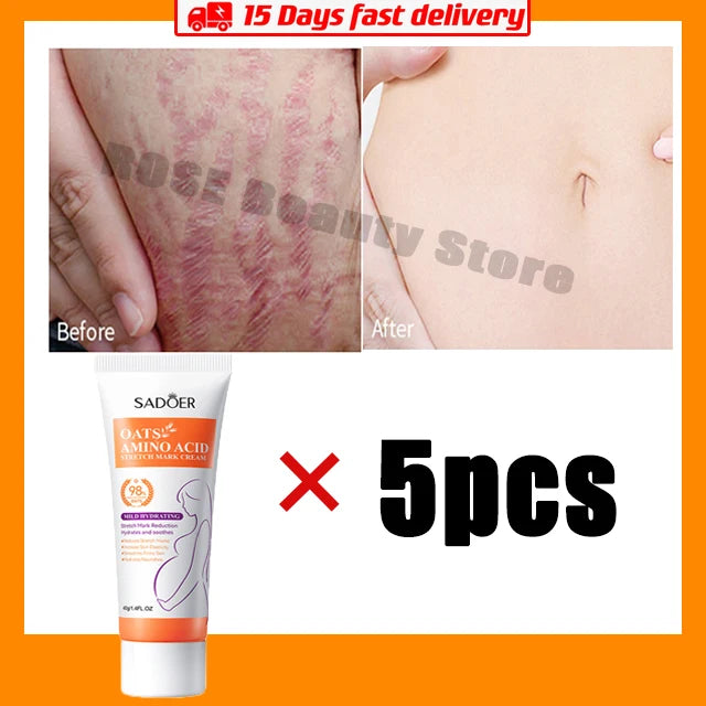 Stretch Marks Permanent Removal Cream Eliminate Body Belly Stretch Marks Swelling Marks Remove Skin Cracks Repair Firming Care Viralgem Store