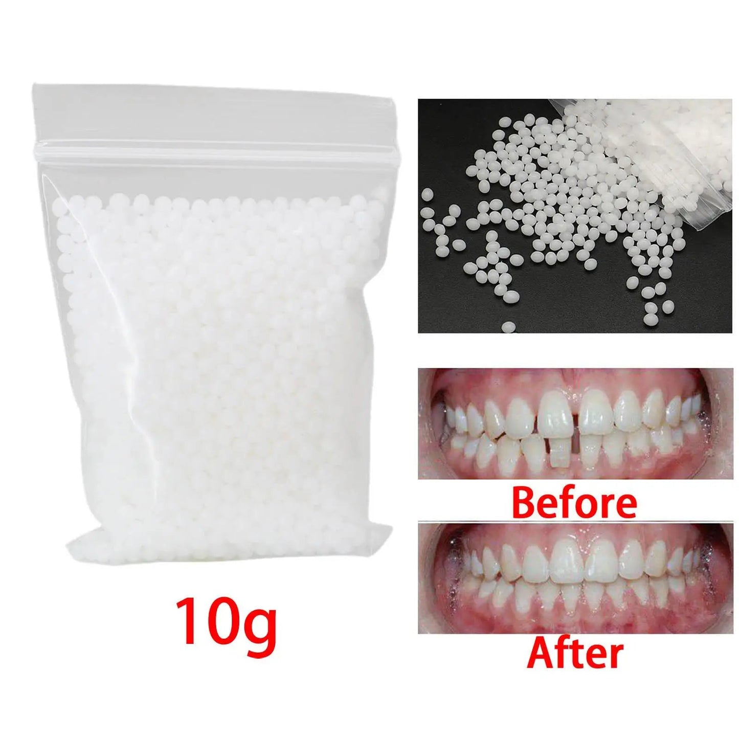 10G Temporary Tooth Solid Glue Fix Missing Broken Gaps Filling Viralgem Store