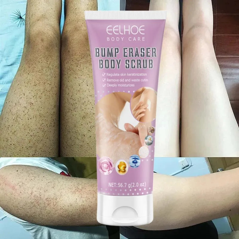 7-Day Fast Body Scrub Cream Moisturizing Skin Repair Keratosis Pilaris Removing Strawberry Legs Eraser Nourishing Body Skin Care Viralgem Store