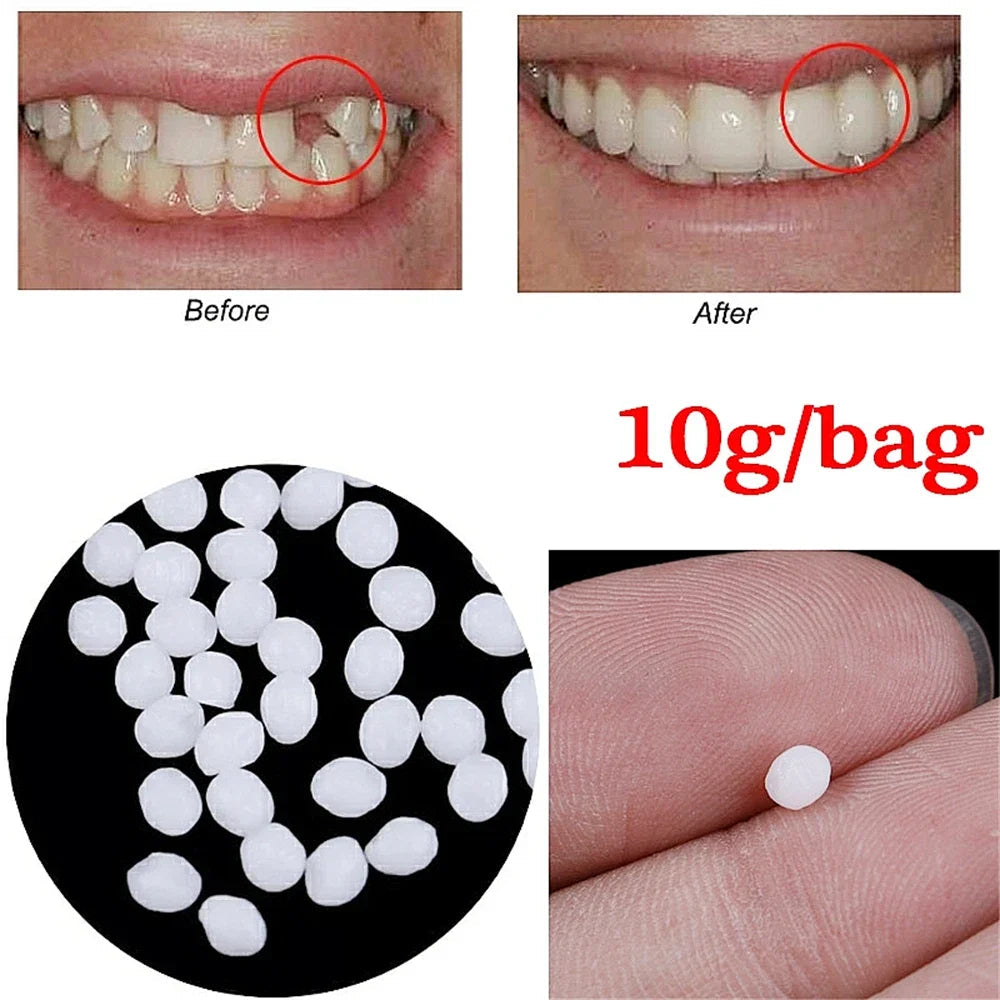 50g Resin Temporary Tooth Repair Granules Teeth Gaps Missing Broken Tooth Filling Moldable Adhesive Dentures False Teeth Tools Viralgem Store