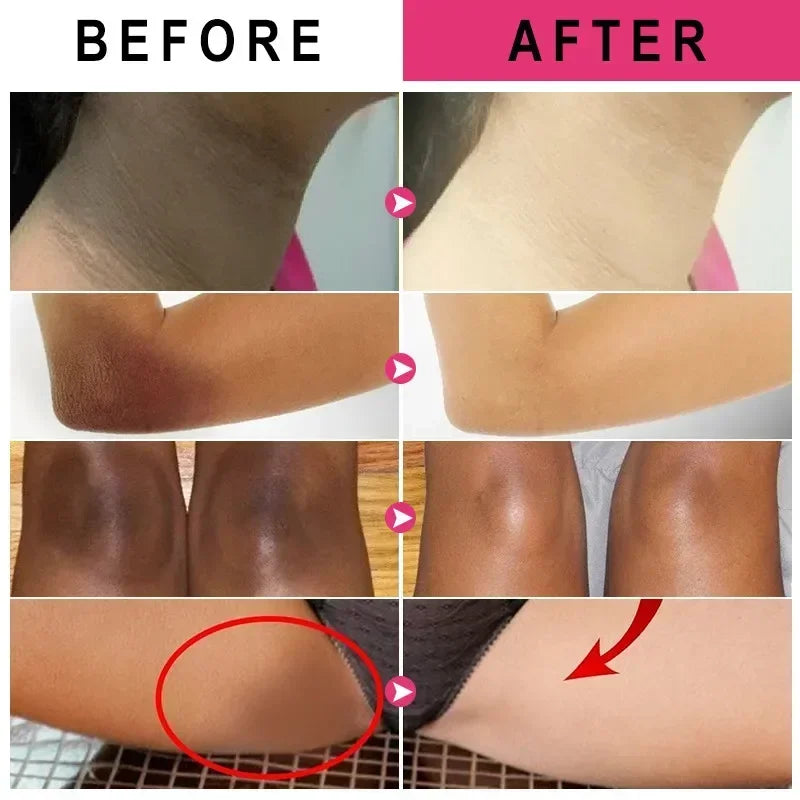 Vitamin C Brightening Cream Whitening Brightening Melanin Intimate Areas Bleaching Legs Knees Elbows Arms Bend Brighten Melanin