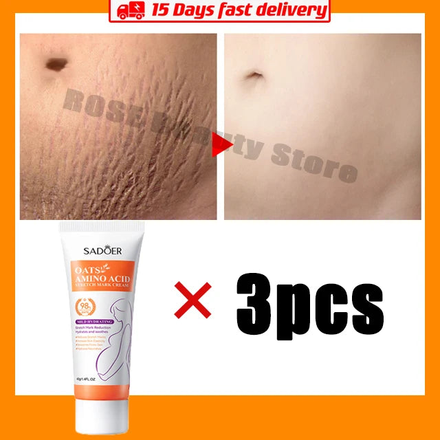 Stretch Marks Permanent Removal Cream Eliminate Body Belly Stretch Marks Swelling Marks Remove Skin Cracks Repair Firming Care Viralgem Store