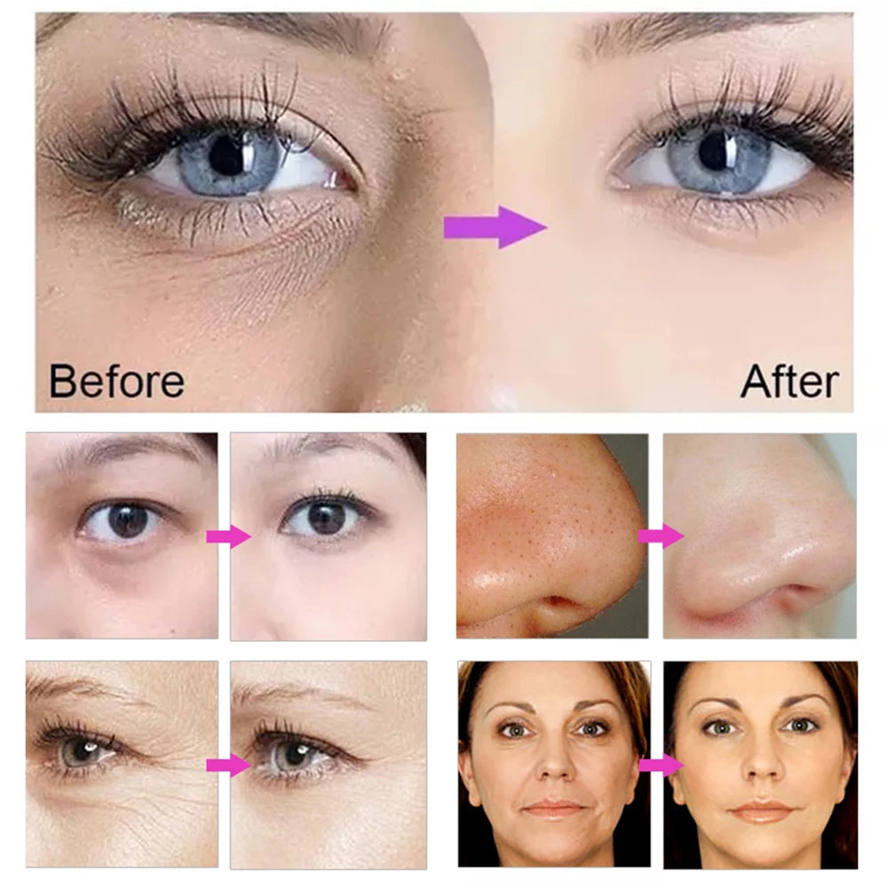 2024 NEW Dcool Portable Cool + Hot + EMS For Skin Tightening Anti Puffiness Facial Electroporation Machine Beauty Device