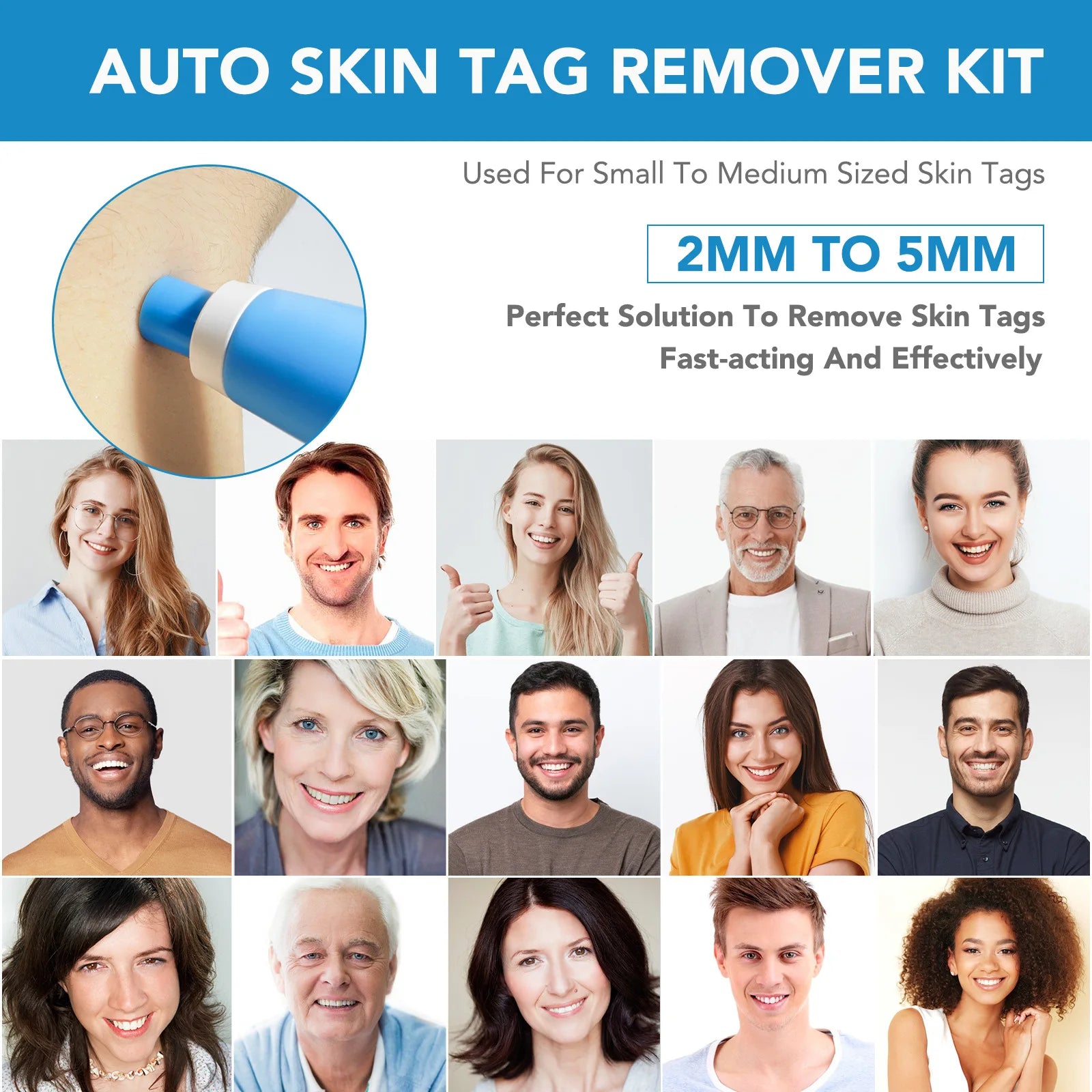 2 IN 1 Auto Micro Skin Tag Remover Device Standard And Micro Skin Tag Removal Kit Adult Mole Wart Remover Face Care Beauty Tools Viralgem Store