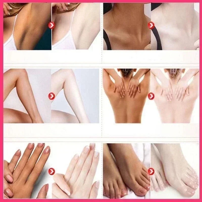 2025Dark knuckles whitening serum Elbows Armpit Beaching Serum Private parts whitening essence Lightens Elbows Knees Underarms Viralgem Store
