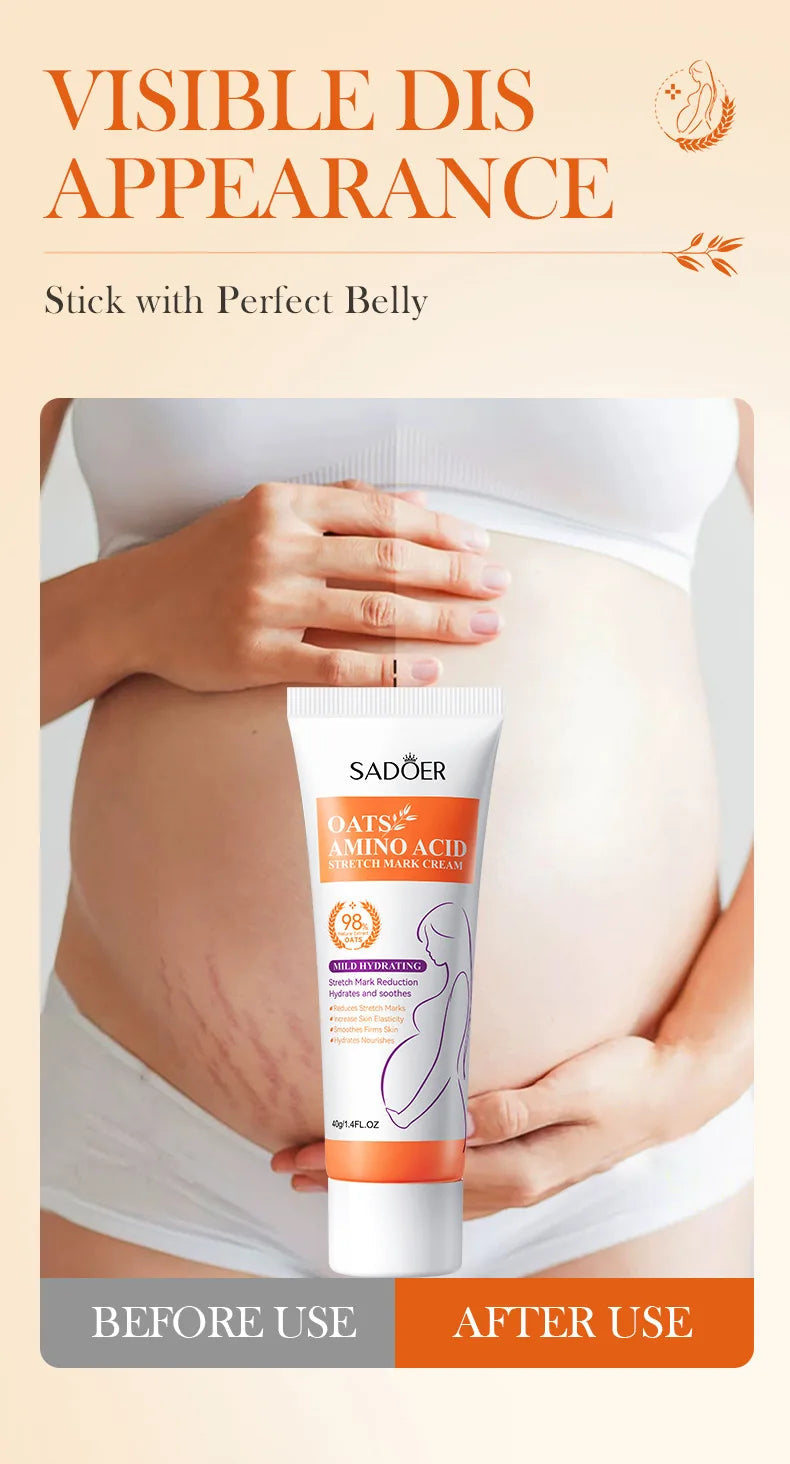 Stretch Marks Permanent Removal Cream Eliminate Body Belly Stretch Marks Swelling Marks Remove Skin Cracks Repair Firming Care Viralgem Store