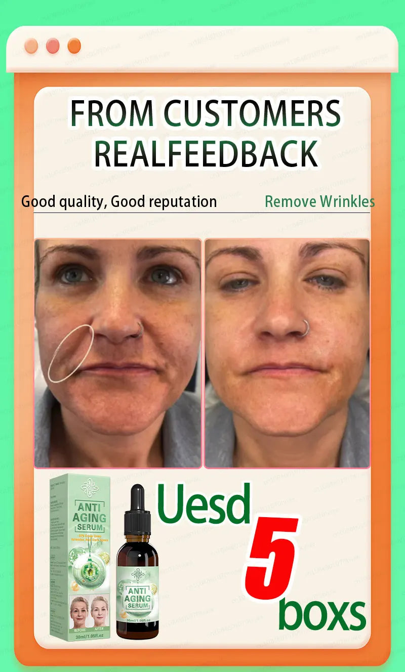 Wrinkles disappear, the first choice for beauty lovers Viralgem Store