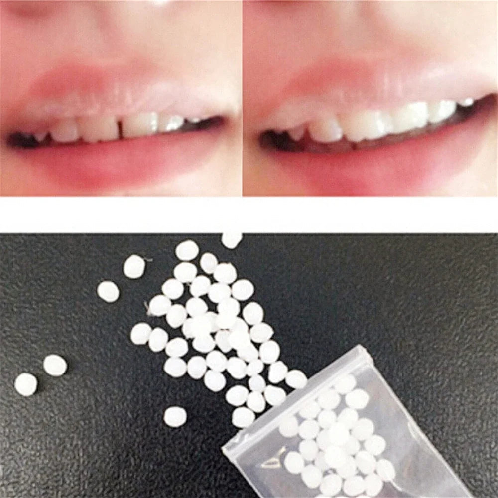 50g Resin Temporary Tooth Repair Granules Teeth Gaps Missing Broken Tooth Filling Moldable Adhesive Dentures False Teeth Tools Viralgem Store