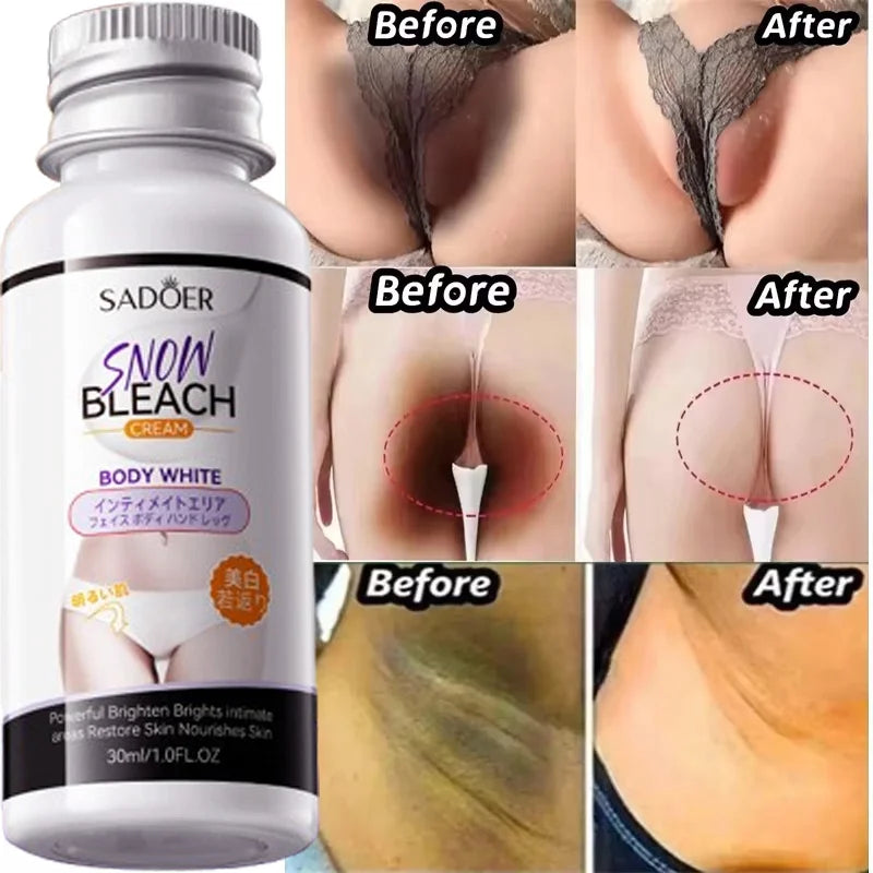 Whitening Cream Private Parts Underarm Bleaching Serum Whiten Butt Knee Brighten Inner Thigh Intimate Parts Dark Remove Melanin Viralgem Store