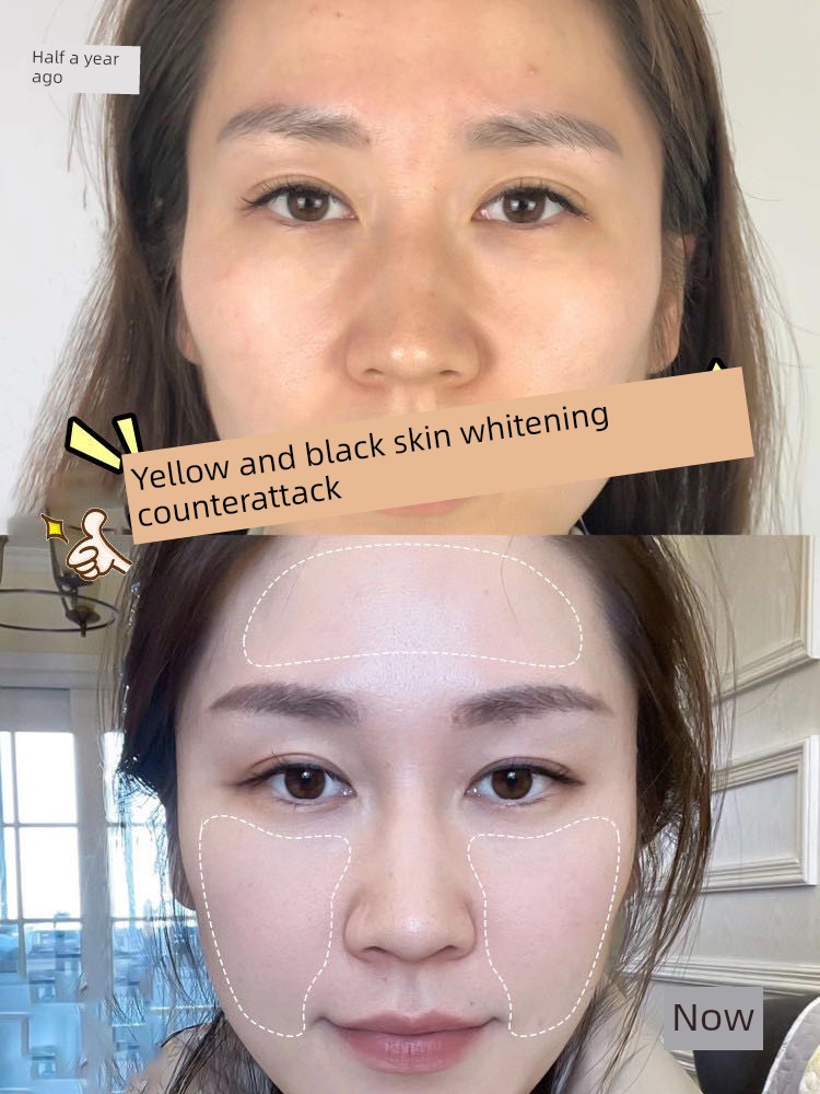 377 Whitening and Freckle Removing Essence Oil Nicotinamide VC Anti-Oxidation Anti-Yellow Brightening Cream Official Flagship Store