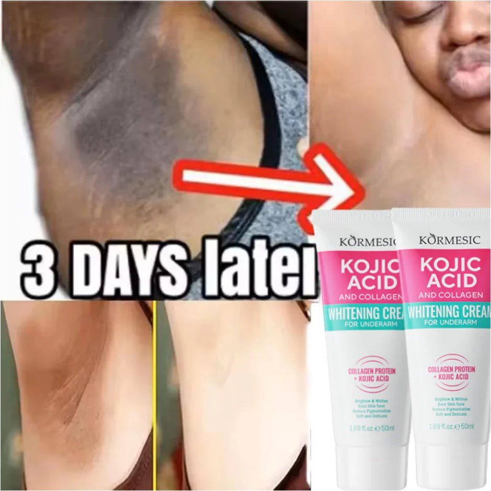 50g Body Underarm Whitening Cream Private Parts Bleaching Whiten Butt Knee Brighten Inner Thigh Intimate Dark Remove Melanin Viralgem Store