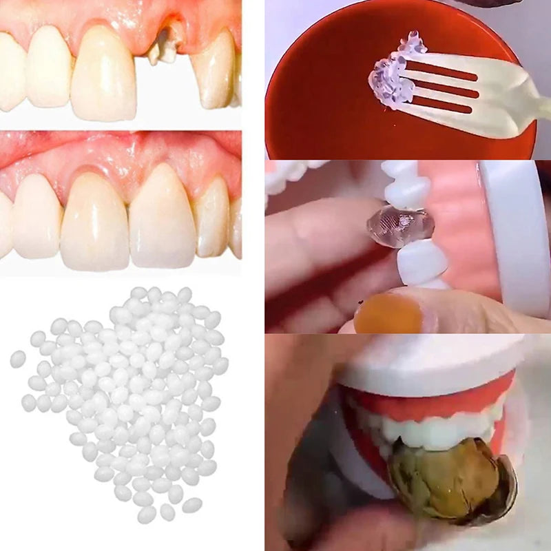 10g-30g Temporary Tooth Repair Kit Teeth And Gaps FalseTeeth Solid Glue Denture Adhesive Teeth Whitening Tooth Beauty Tool Viralgem Store