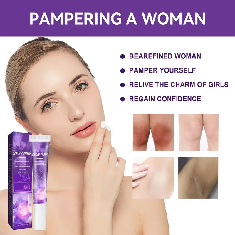 Whitening Cream Private Parts Underarm Bleaching Serum Whiten Butt Knee Brighten Intimate Parts Dark Remove Melanin Viralgem Store