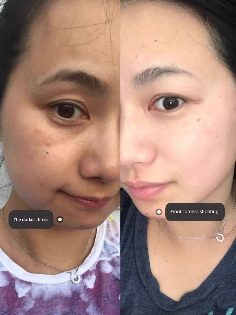 377 Whitening and Freckle Removing Essence Oil Nicotinamide VC Anti-Oxidation Anti-Yellow Brightening Cream Official Flagship Store