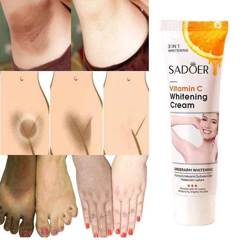 Vitamin C Brightening Cream Whitening Brightening Melanin Intimate Areas Bleaching Legs Knees Elbows Arms Bend Brighten Melanin