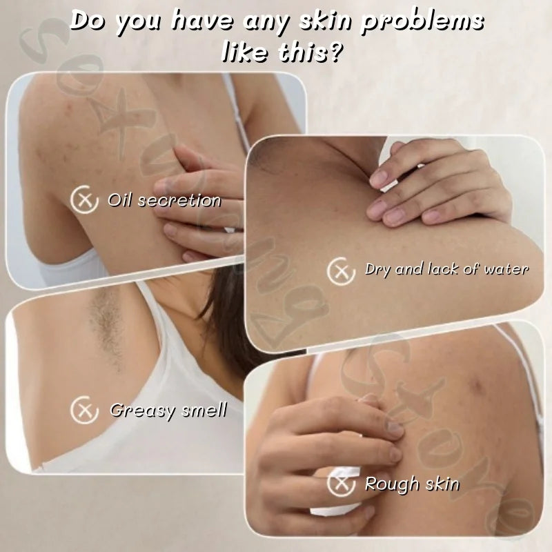 300g OHBT body lotion nourishes and cares for the skin to improve acne, rough and dry skin texture is refreshing and not greasy Viralgem Store