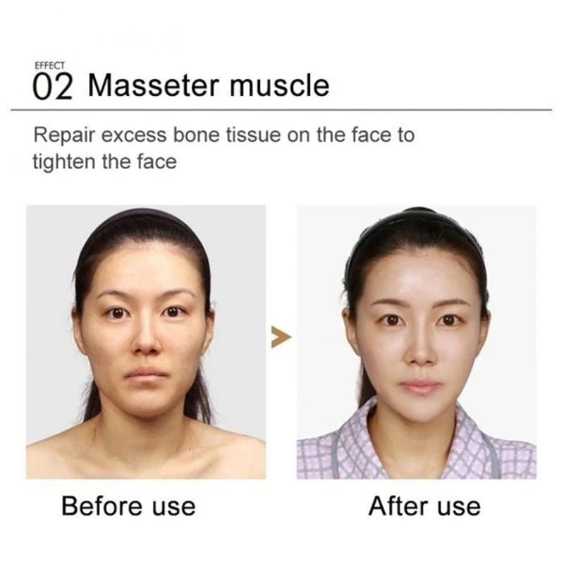 V-Shape Slimming Cream Firming Face-lift Slimming Removal Masseter Muscle Double Chin Face Fat Burning Anti-aging Products