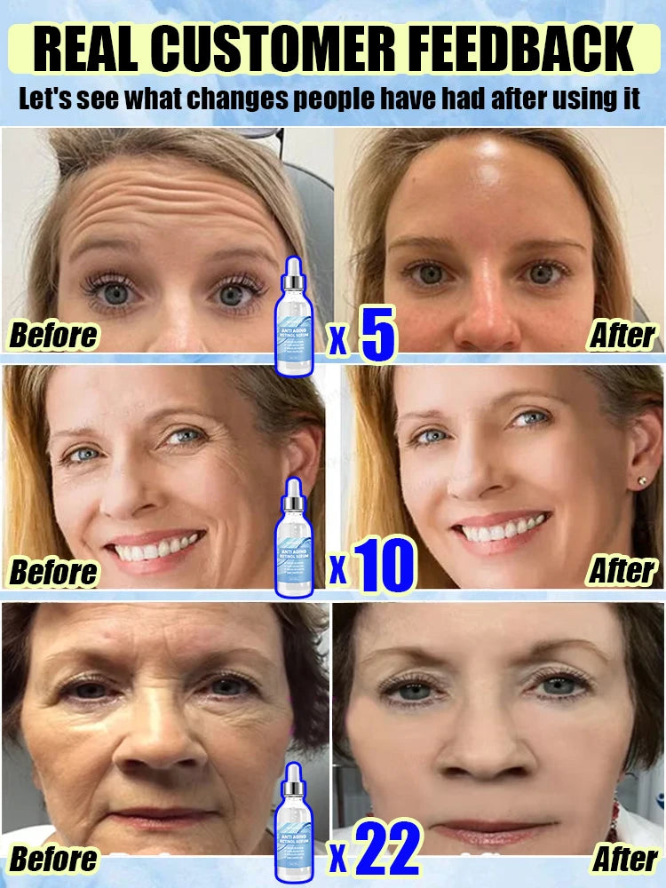 Wᵣᵢₙₖₗₑ ᵣₑₘₒᵥₐₗ Viralgem Store