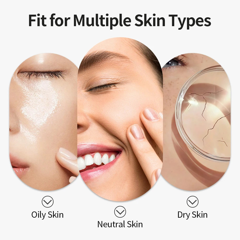 USB Rechargeable Electric Blackhead Remover Vacuum Face Pore Cleaner Whiteheads Black Spots Pimple Acne Extractor Skin Care Set Viralgem Store