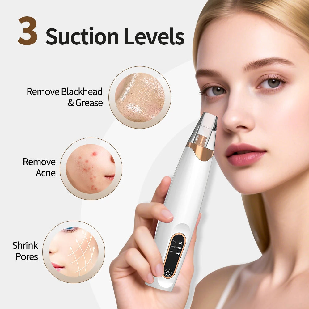 USB Rechargeable Electric Blackhead Remover Vacuum Face Pore Cleaner Whiteheads Black Spots Pimple Acne Extractor Skin Care Set Viralgem Store
