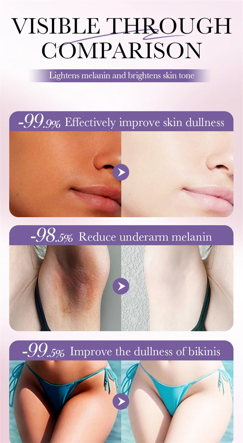 Whitening Cream Private Parts Underarm Bleaching Serum Whiten Butt Knee Brighten Inner Thigh Intimate Parts Dark Remove Melanin Viralgem Store