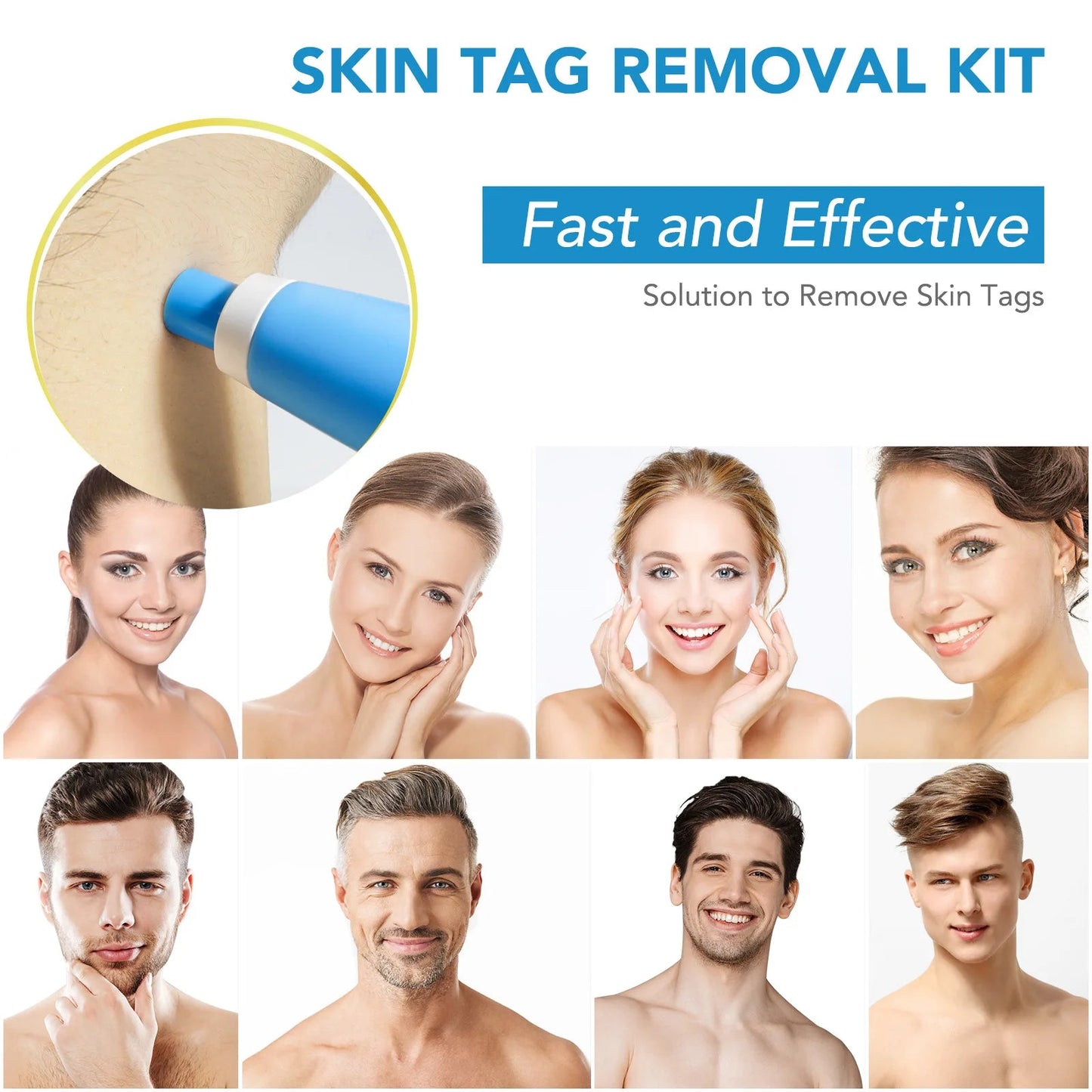 2 IN 1 Auto Micro Skin Tag Remover Device Standard And Micro Skin Tag Removal Kit Adult Mole Wart Remover Face Care Beauty Tools Viralgem Store