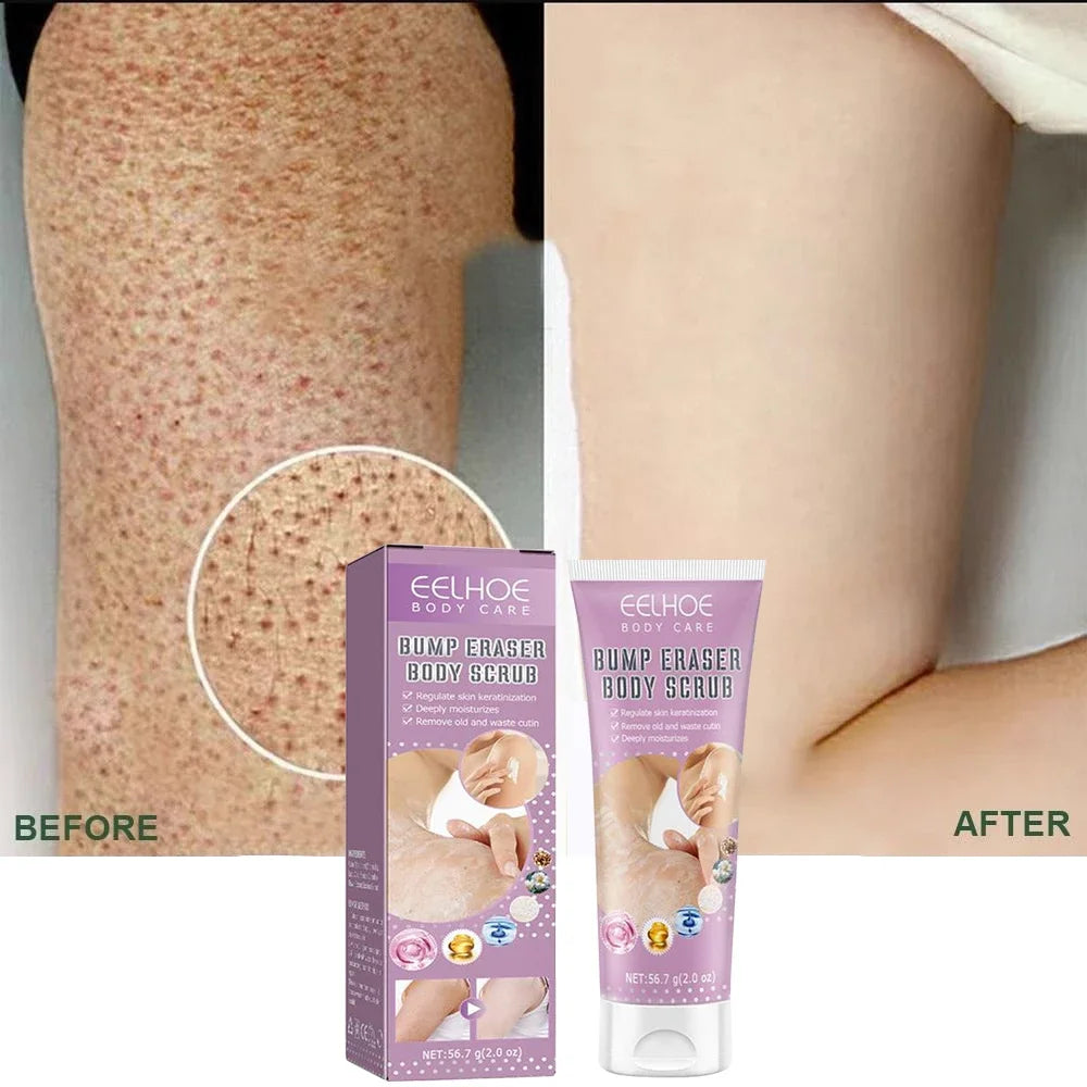 7-Day Fast Body Scrub Cream Moisturizing Skin Repair Keratosis Pilaris Removing Strawberry Legs Eraser Nourishing Body Skin Care Viralgem Store