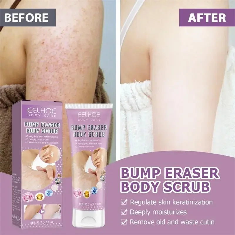 7-Day Fast Body Scrub Cream Moisturizing Skin Repair Keratosis Pilaris Removing Strawberry Legs Eraser Nourishing Body Skin Care Viralgem Store