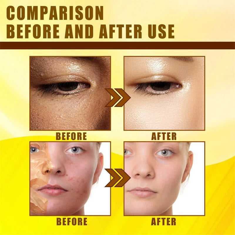 Yellow Peeling Oil Body Cleansing Exfoliation For Tender Glowing Skin Finger Joint Whitening Moisturizing Care Beauty Products