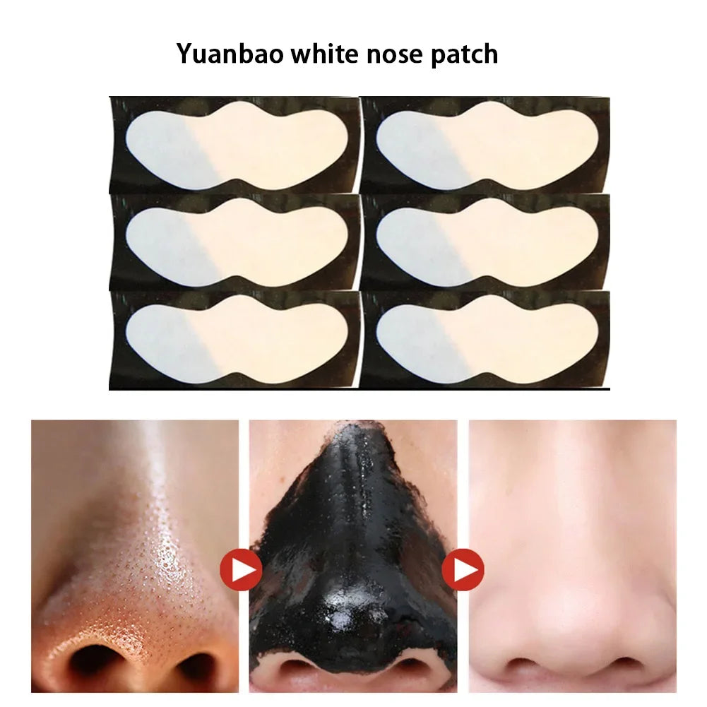 10PCS Nose Blackhead Remover Mask Deep Cleansing Skin Care Shrink Pore Acne Treatment Mask Nose Black Dots Pore Clean Strips Viralgem Store