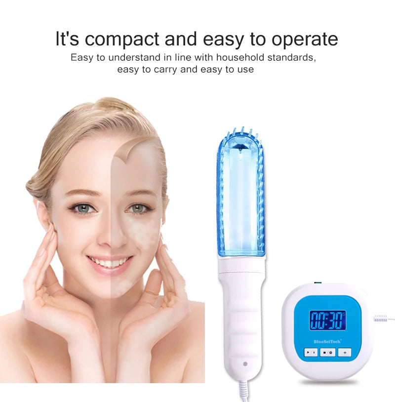 UV 311nm Ultraviolet Phototherapy Device Uses UVB Lamp To Treat Vitiligo, Psoriasis, White Spots And Skin Diseases