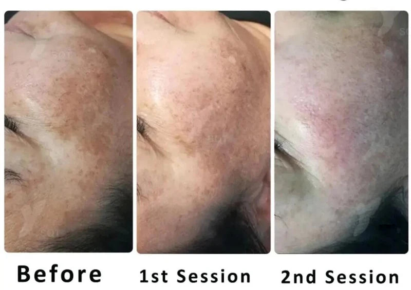 10pcs Sponge Microcrystal Freeze-dried Powder Collagen Regeneration Natural Biological Extract Sponge Spicules Skin Cell Renew Viralgem Store