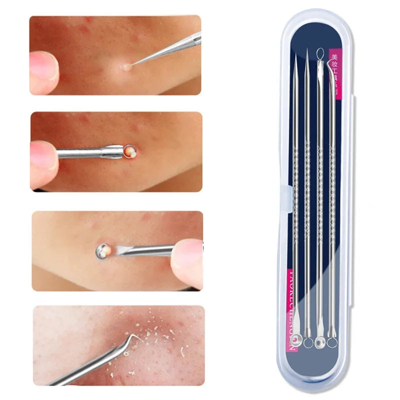 4PCS Acne Blackhead Comedone Black Spot Pimple Blemish Remover Skin Care Women Beauty Acne Treatment Pore Cleanser Needle Hook