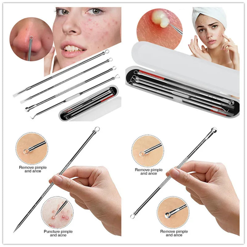 4Pcs Blackhead Black Spot Acne Comedone Pimple Blemish Remover Skin Care Women Beauty Acne Treatment Pore Cleanser Needle Hook Viralgem Store