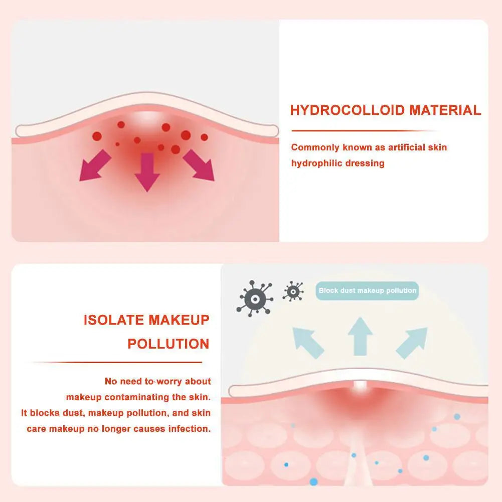 600pcs Large Size Star Acne Patch Mild Non-irritating Lightens Acne Hydrocolloid Acne Sticker For Blackheads Closed Comedones