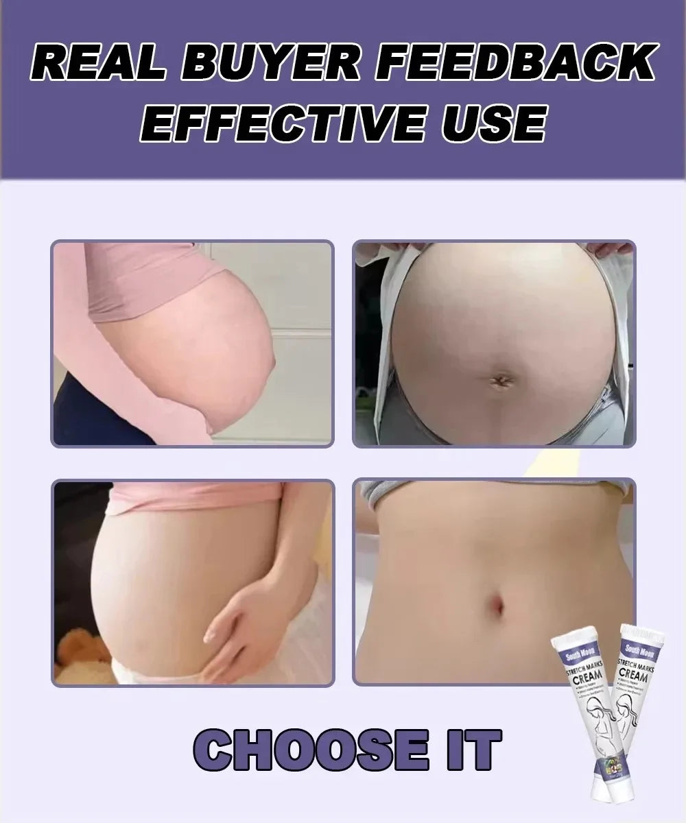 Stretch Marks Permanent Removal Cream Eliminate Body Belly Stretch Marks Swelling Marks Remove Skin Cracks Repair Firming Care Viralgem Store